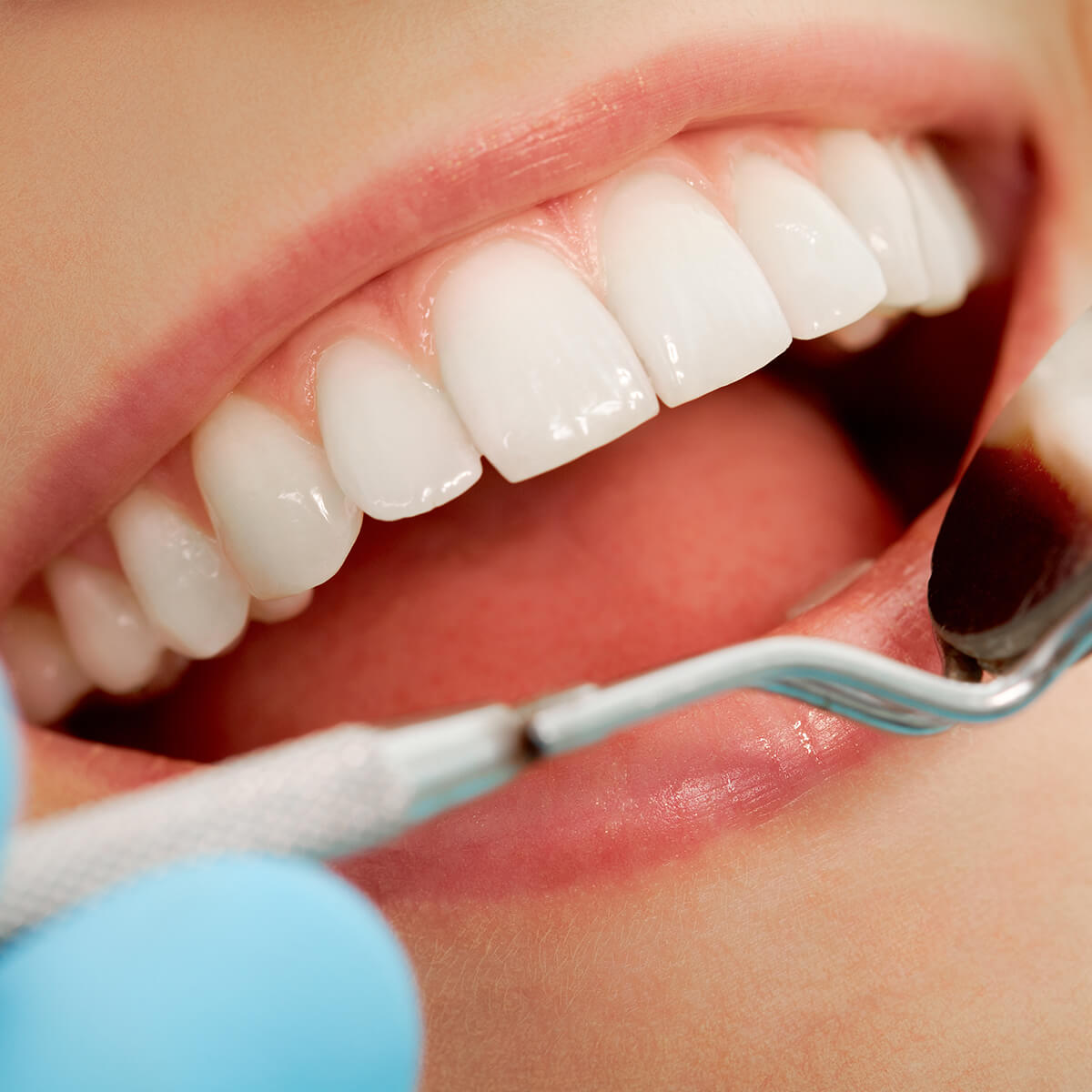 Why professional dental cleanings and checkups are important for your oral health