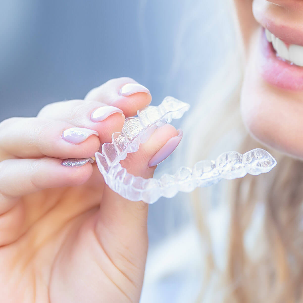 How To Remove Suresmile Aligners in London ON Area